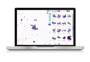 AI diagnostic models for digital pathology - KFBIO AI pathology