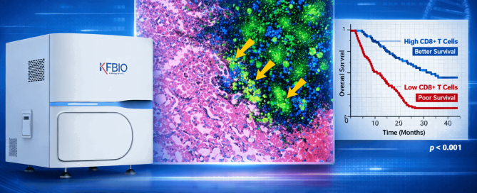 Digital Pathology Breakthrough KF-PRO-400 Scanner Enables Biomarker Discovery in Intrahepatic Cholangiocarcinoma Research