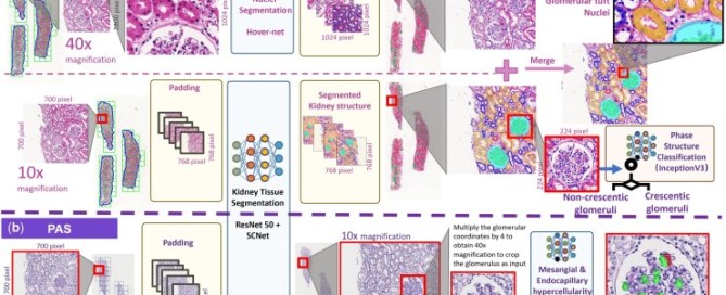 Overview of whole slide image detection and segmentation pipeline. (a) Nuclei detection and kidney tissue structure segmentation processes were performed using APKD based on 40× magnification H&E images and 10× magnification H&E images, respectively. (b) Endocapillary hypercellularity (indicated in green region) and mesangial hypercellularity (indicated in red region) detection process were performed using APKD based on 40× magnification PAS images.