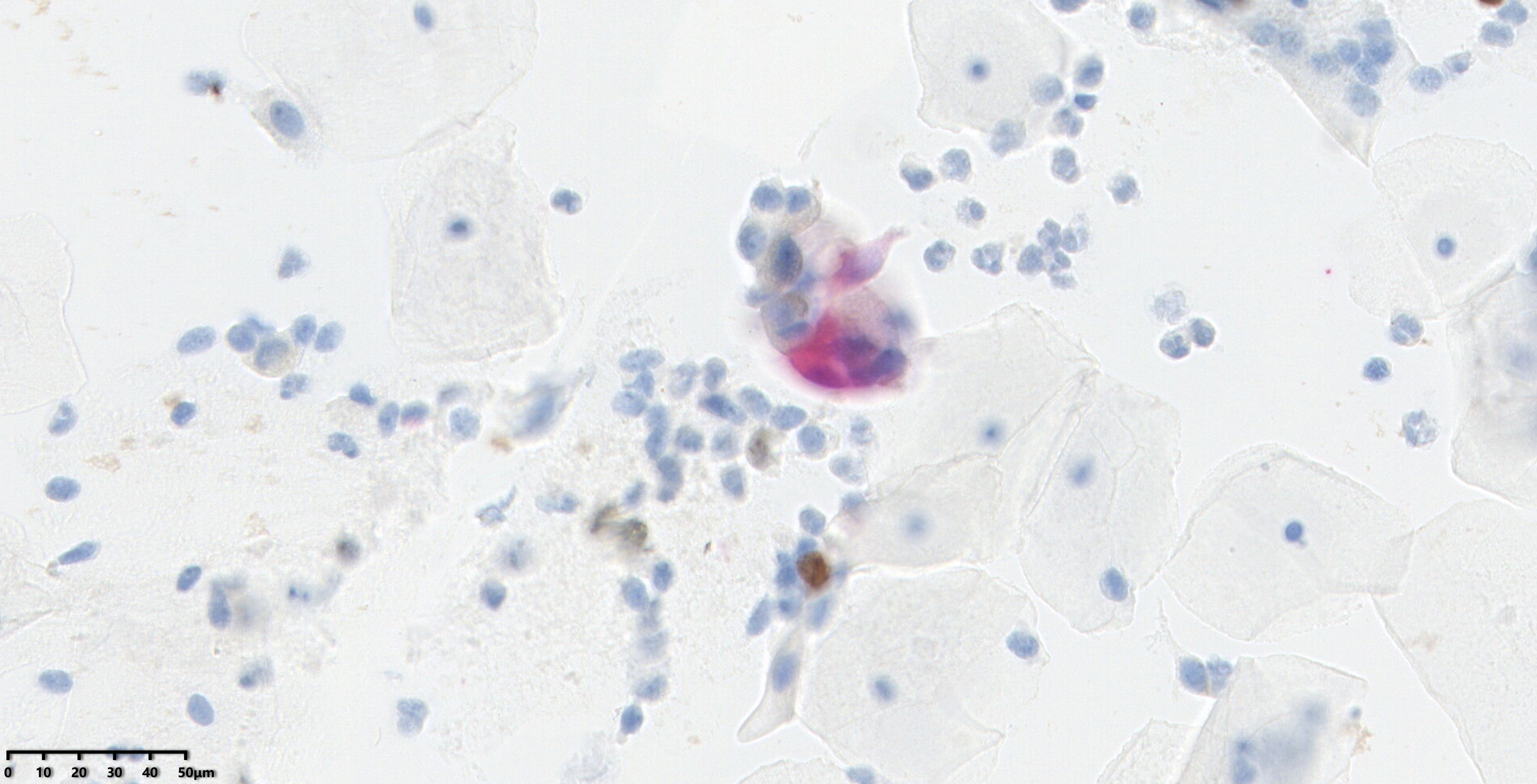 599-case clinical study results