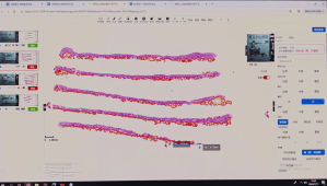 AI-assisted gastric biopsy analysis improves lesion detection and supports accurate pathology diagnosis.